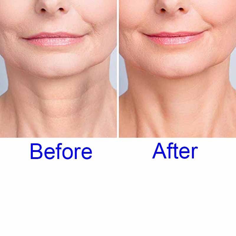 (Hàng Mới Về) Miếng Dán Silicon Trong Suốt Tái Sử Dụng Chống Nếp Nhăn Lão Hóa Da Vùng Cổ | BigBuy360 - bigbuy360.vn