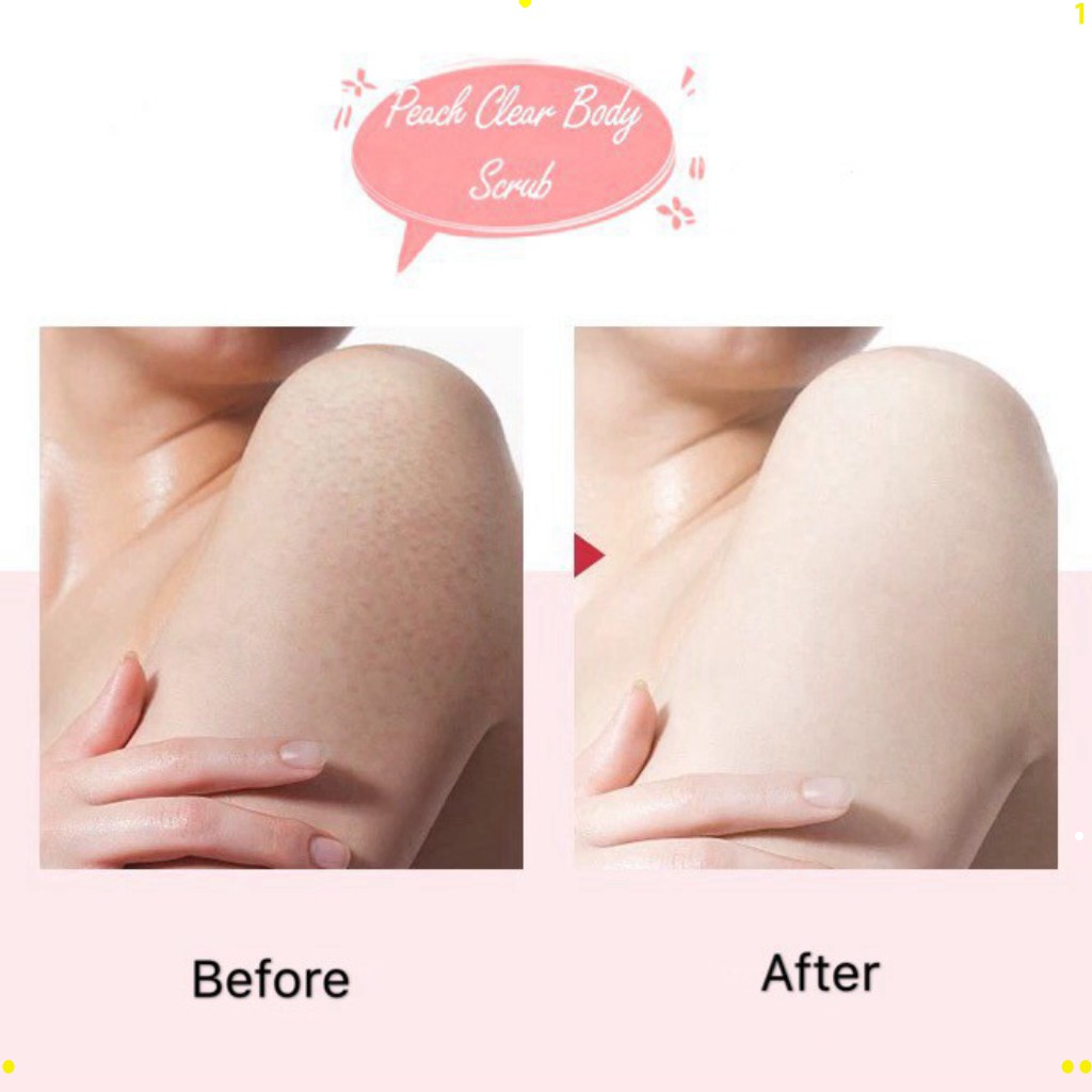 Tẩy da chết toàn thân đào HEYXI Peach Clear, tẩy tế bào chết body đào, kem thải độc tố da, xe khít lỗ chân lông HOT | BigBuy360 - bigbuy360.vn