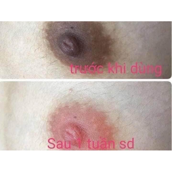 Chống Thâm Môi - Làm Hồng Nhũ Hoa - Vùng Kín Pei Mei | BigBuy360 - bigbuy360.vn