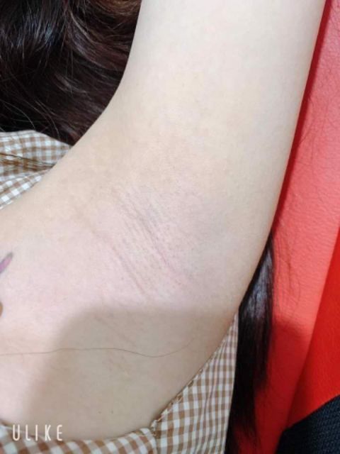 Kem tẩy lông,serum triệt lông vĩnh viễn | BigBuy360 - bigbuy360.vn