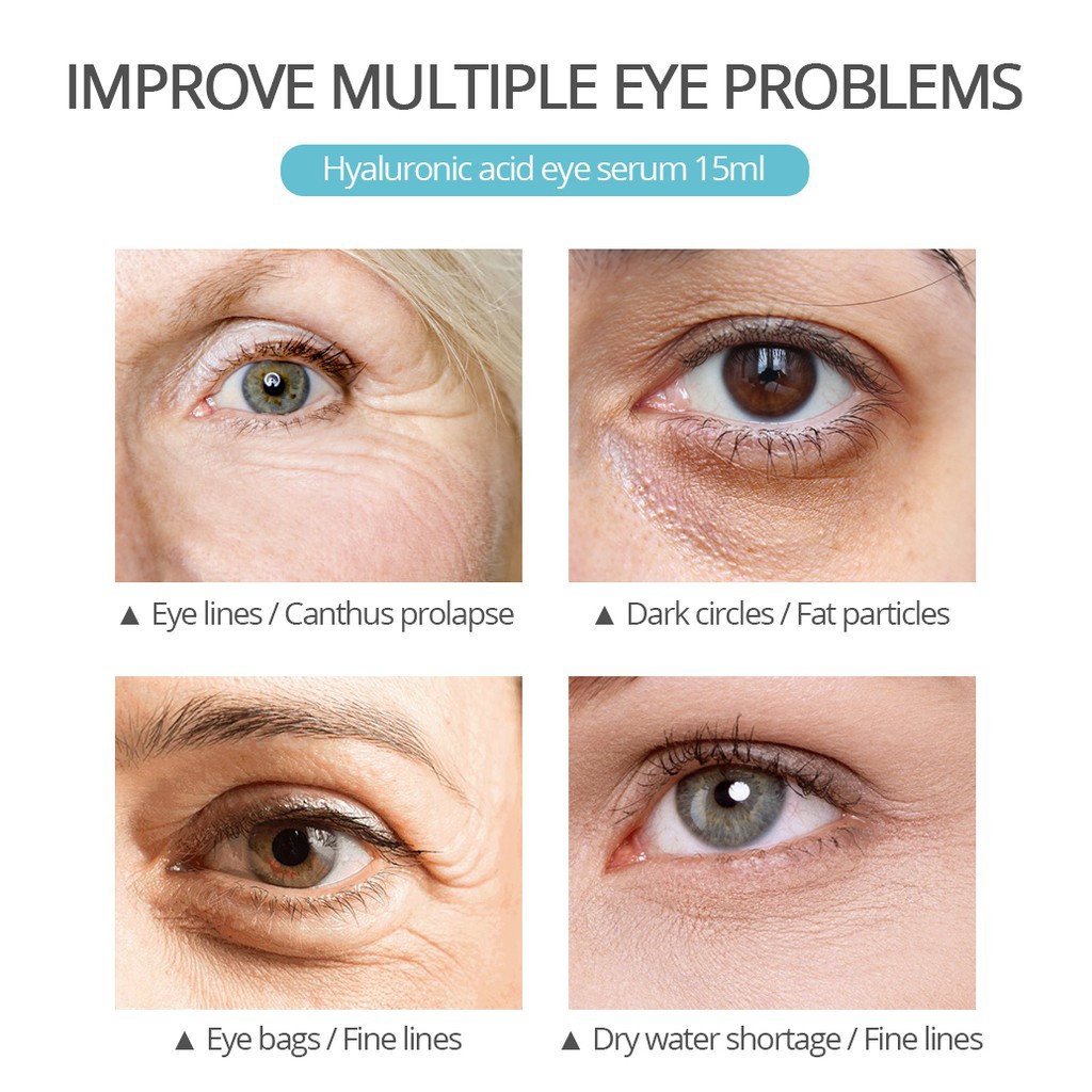 Mặt nạ mắt Hyaluronic Acid Eye Serum Vibrant Glamour phục hồi da làm mờ nếp nhăn xóa quầng thâm 15ml | BigBuy360 - bigbuy360.vn