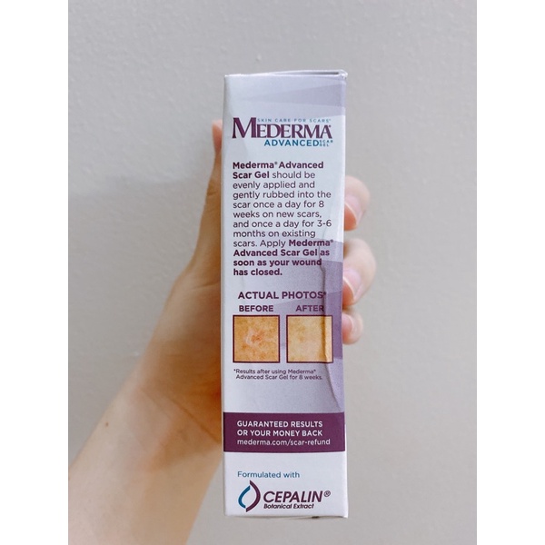 Kem làm mờ sẹo số 1 của Mỹ MEDERMA 20g date 12/2022 | BigBuy360 - bigbuy360.vn
