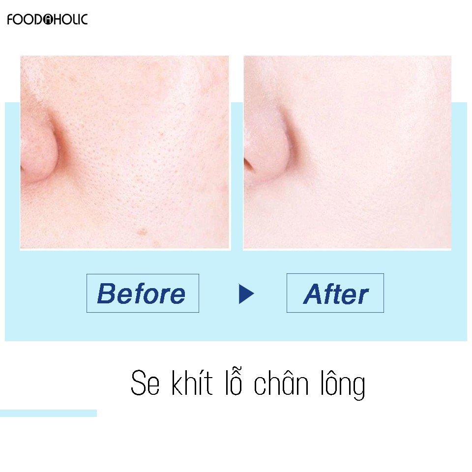 Combo 5 Mặt Nạ Chống Lão Hóa, Bổ Sung Collagen Mờ Nếp Nhăn Foodaholic Firm Collagen Anti Aging Essential Mask 23g x 5