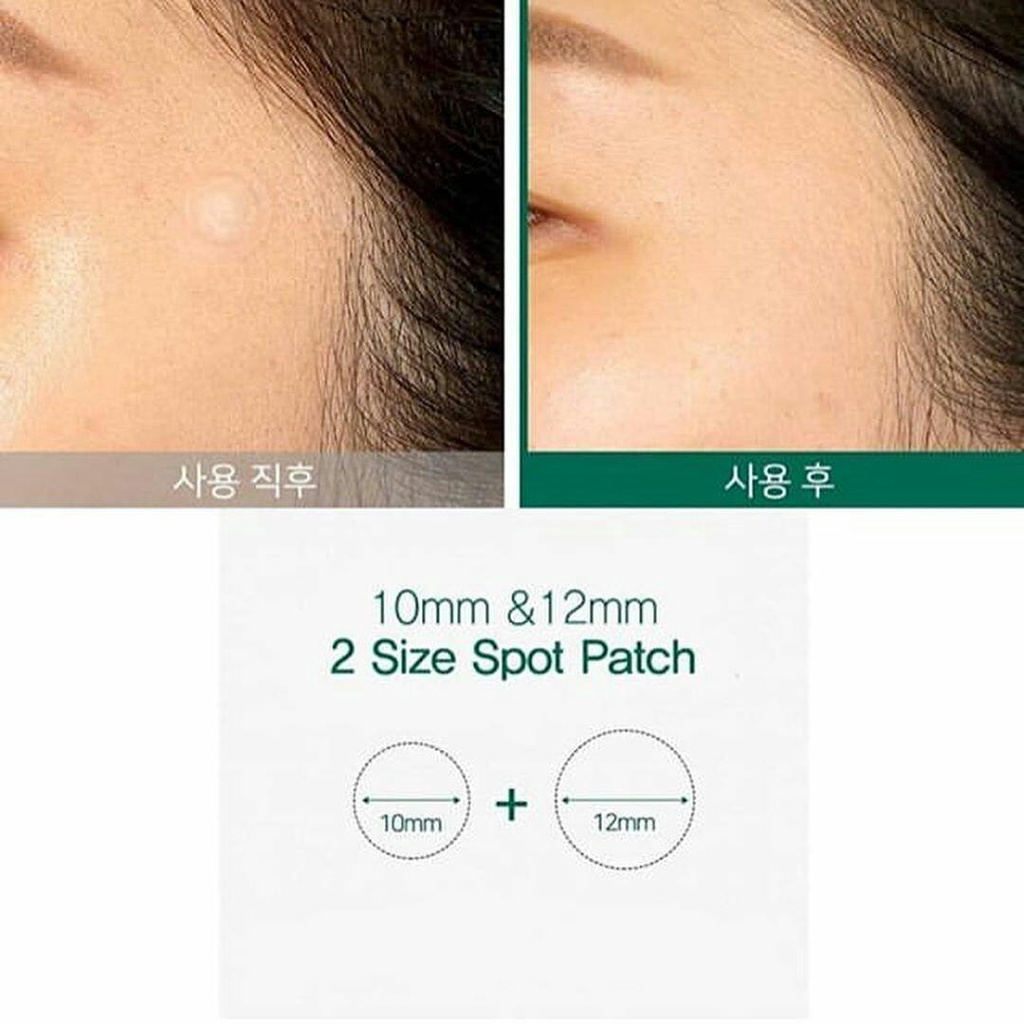 Miếng Dán Mụn Some By Mi Clear Spot Patch - Elbi Beauty Cosmetics &amp; Skincare