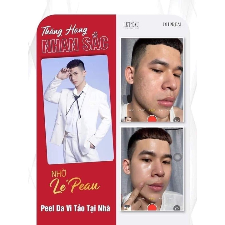 LE’PEAU peel vi tảo