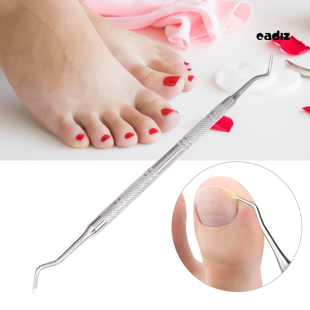 [Hàng mới về] Dụng cụ nâng móng chân/móng tay mọc ngược