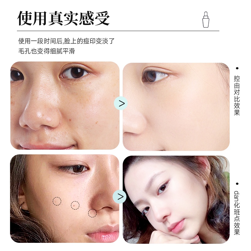 Tinh Chất Clinique 302 Giúp Dưỡng Trắng Da 50ml/100ml Cao Cấp