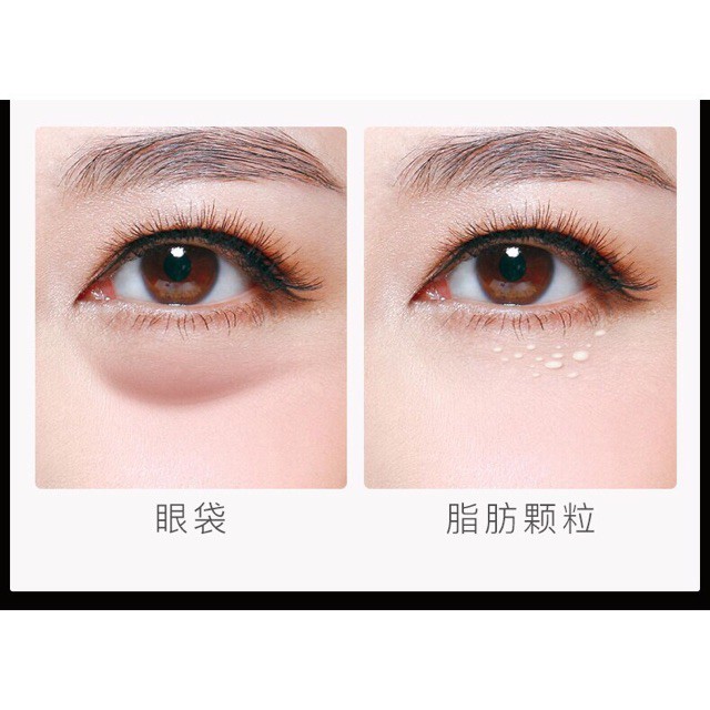 Mặt nạ  giảm  bọng  và quầng thâm mắt và nếp nhăn khoé miệng Beotua | BigBuy360 - bigbuy360.vn