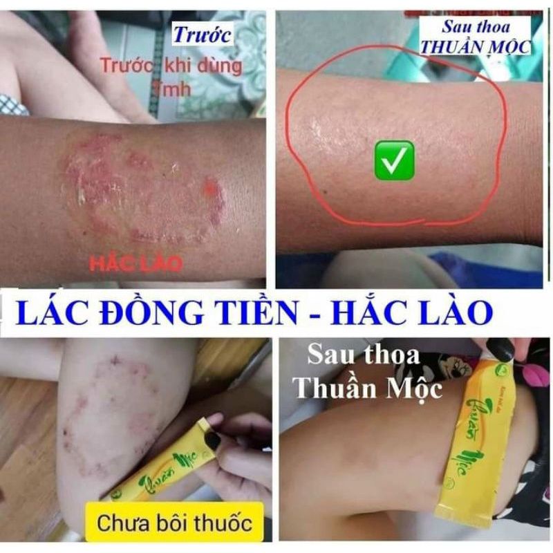 Kem bôi da Thuần Mộc