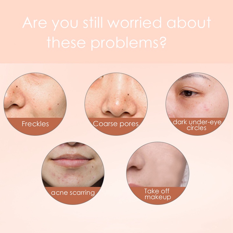 [Hàng mới về] Kem che khuyết điểm hỗ trợ che phủ tàn nhang/ mụn/ quầng thâm hiệu quả