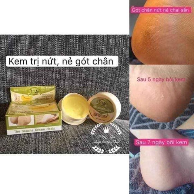 KEM TRỊ NỨT NẺ GÓT CHÂN CHUỐI THIALAND