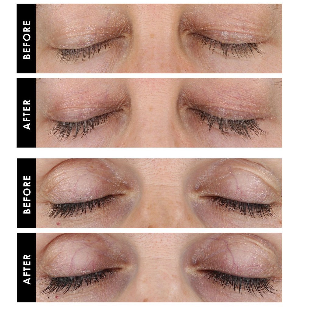 Huyết thanh dưỡng mi GrandeLash MD Lash Enhancing Serum Grande Cosmetics 0.7ml Date 3/24