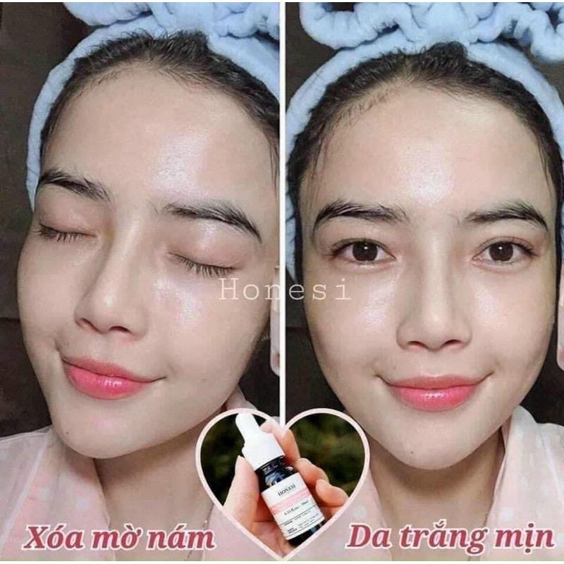 Tinh chất serum tế bào gốc ngừa nám tàn nhang Honesi