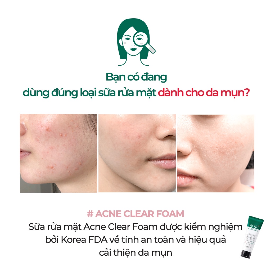 Sữa rửa mặt và miếng dán mụn Some By Mi AHA-BHA-PHA 30 Days Miracle Acne Clear Foam