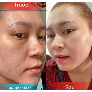 KEM 4K PLUS CHÍNH HÃNG DATE MỚI