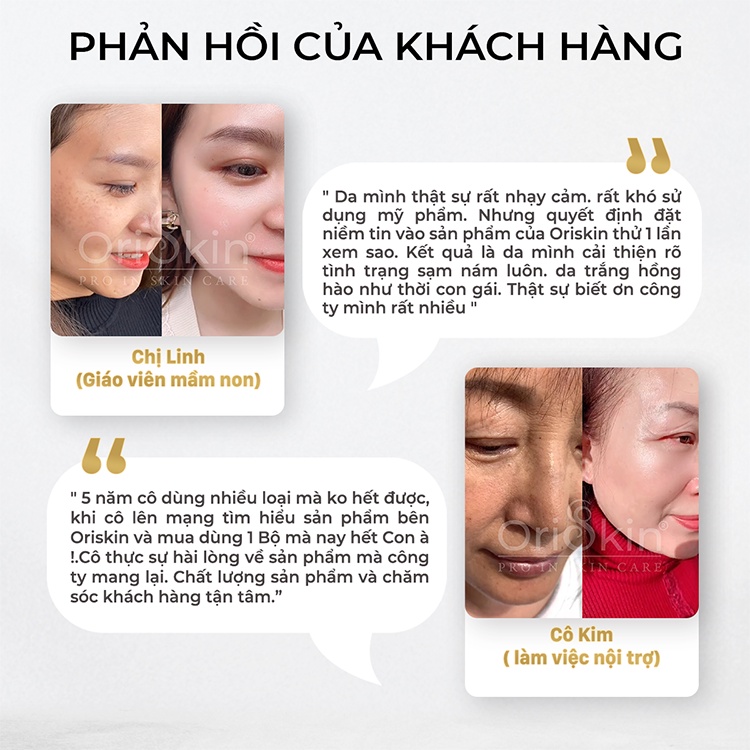 Bộ đôi kem dưỡng giảm Nám Nhỏ ORISKIN MELASMA WHITENING CREAM 6g và kem chống nắng ORISKIN UV PERFECT SUN CREAM 20ml