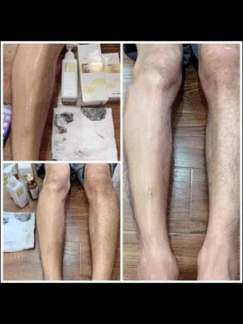 TẨY LÔNG HUYỀN PHI (tặng kèm serum triệt lông  tri gia 180k ) | BigBuy360 - bigbuy360.vn