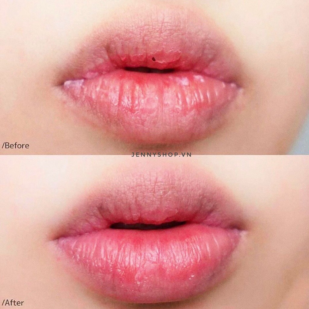 TẨY DA CHẾT SỦI BỌT THẢI ĐỘC MÔI BUBI BUBI BUBBLE LIPS CRUB MẪU MỚI 2021 | BigBuy360 - bigbuy360.vn