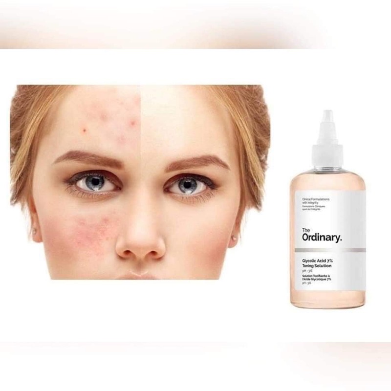 [Bill Sephora US] Nước hoa hồng tẩy tế bào da chết Toner AHA The Ordinary Glycolic Acid 7% Toning 240ml fullsize fullbox