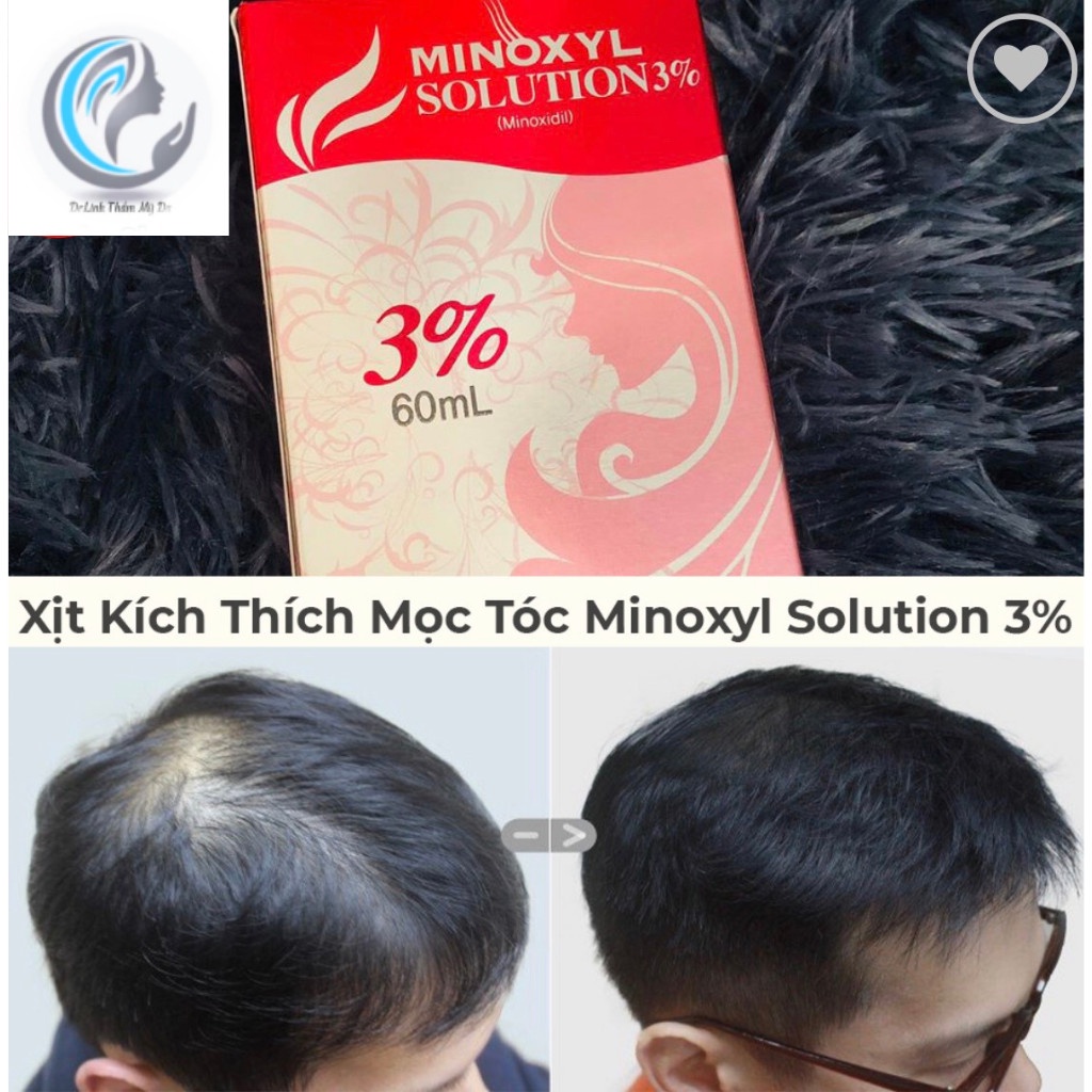 Xịt kích thích mọc tóc Minoxidil 3% MT01
