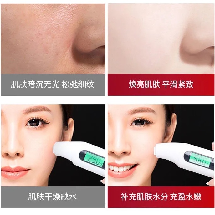 Kem Dưỡng Da Trứng Cá Muối Cấp Ẩm Làm Săn Chắc Da