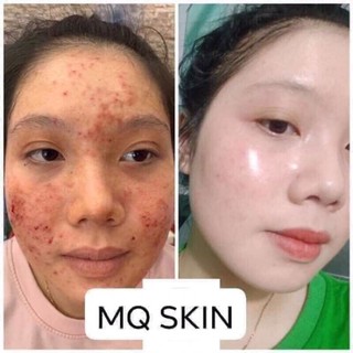 Thay Da Nhân sâm mq ko sưng mẫu mới