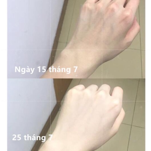 Mặt Nạ Niacinamide Vitamin B3 Làm Trắng Và Cải Thiện Tông Màu Da