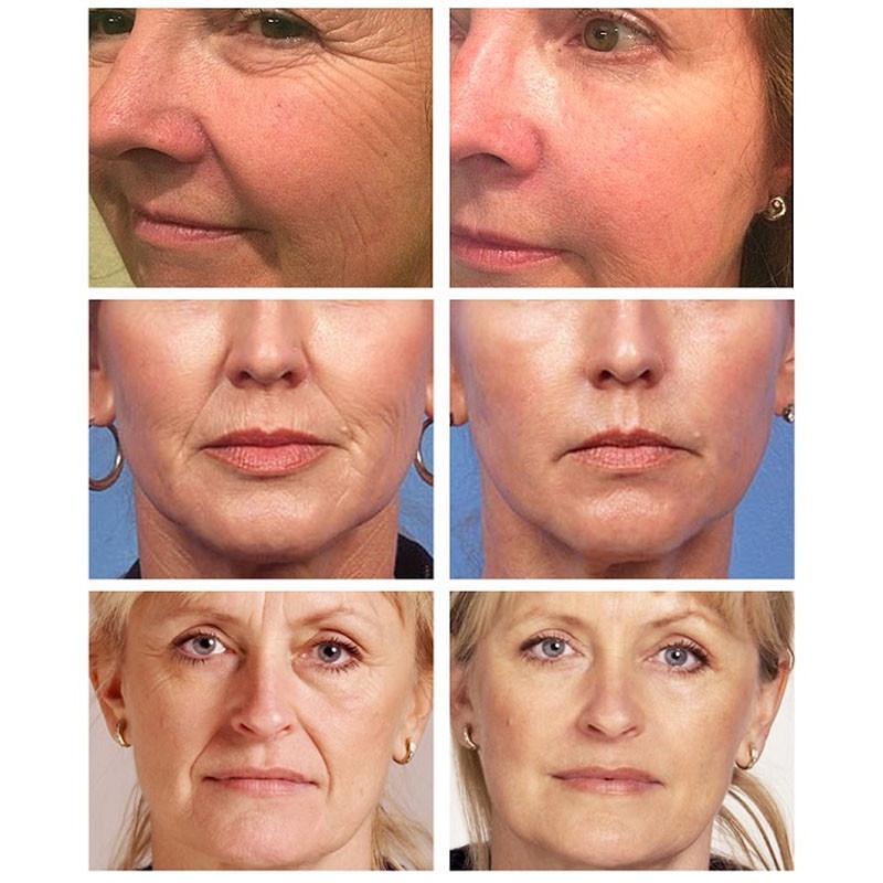 Kem Dưỡng Da Mặt 20g Chứa Retinol Chống Lão Hóa Xóa Mờ Nếp Nhăn Làm Trắng Da Dưỡng Ẩm
