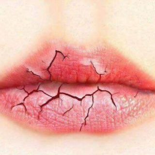 Ủ môi love [ chính hãng]