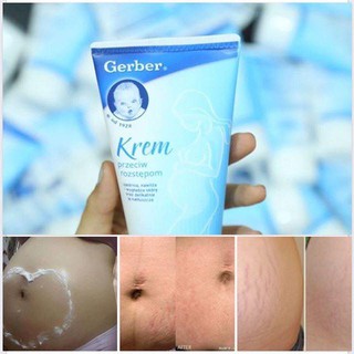 Kem trị rạn da gerber krem