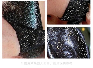 COMBO GEL LỘT MỤN THAN TRE