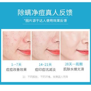 Xà Phòng Làm Sạch Da
