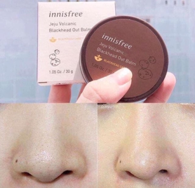 Sáp tiêu mụn đầu đen innisfree