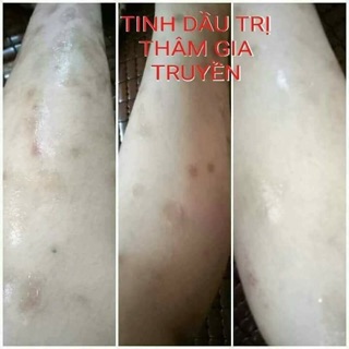 Tinh chất Ngọc Thiên Hương