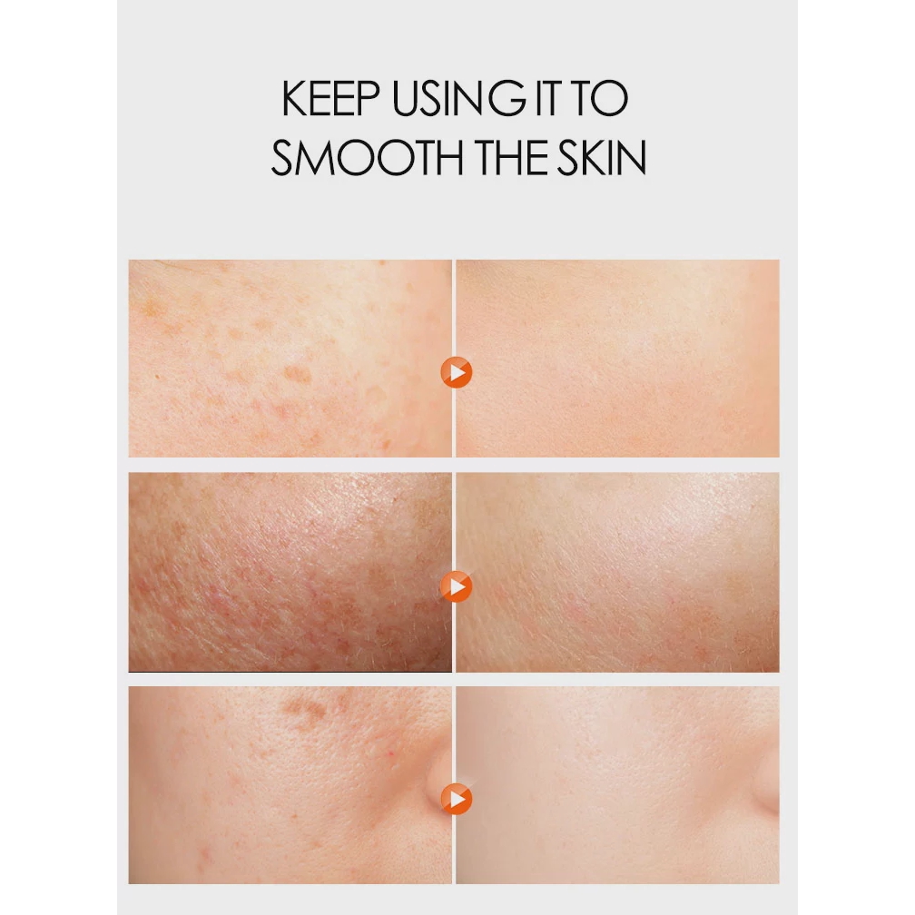 Kem làm trắng da DR.RASHEL chiết xuất Arbutin Niacinamide giảm sắc tố dưỡng ẩm ban ngày
