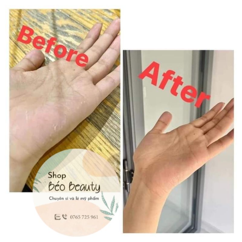 BODY OIL BHA 4% TẨY DA CHẾT HÓA HỌC | BigBuy360 - bigbuy360.vn