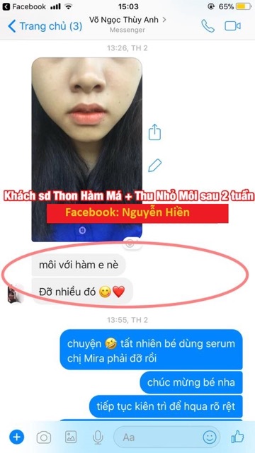 Tinh chất thon hàm má, thu xương quai hàm, hạ gò má cao | BigBuy360 - bigbuy360.vn