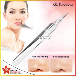NHÍP GẮP MỤN ĐẦU NHỌN ĐA NĂNG NHỎ GỌN TIỆN DỤNG