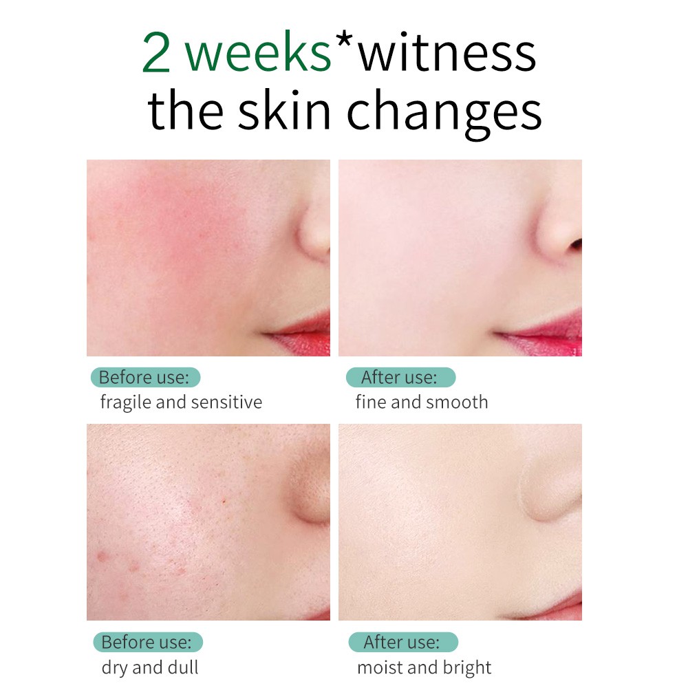 Toner Rau Má SKIN EVER Dưỡng Ẩm Phục Hồi Da Dịu Nhẹ 110ml | BigBuy360 - bigbuy360.vn