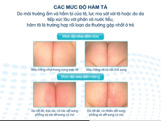 Xịt trị HĂM TÃ Sanyrene 20ml