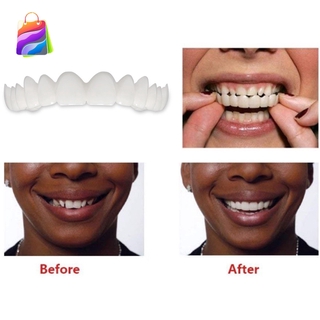 [Hàng mới về] Khuôn niềng răng giả giúp tạo nụ cười hoàn hảo