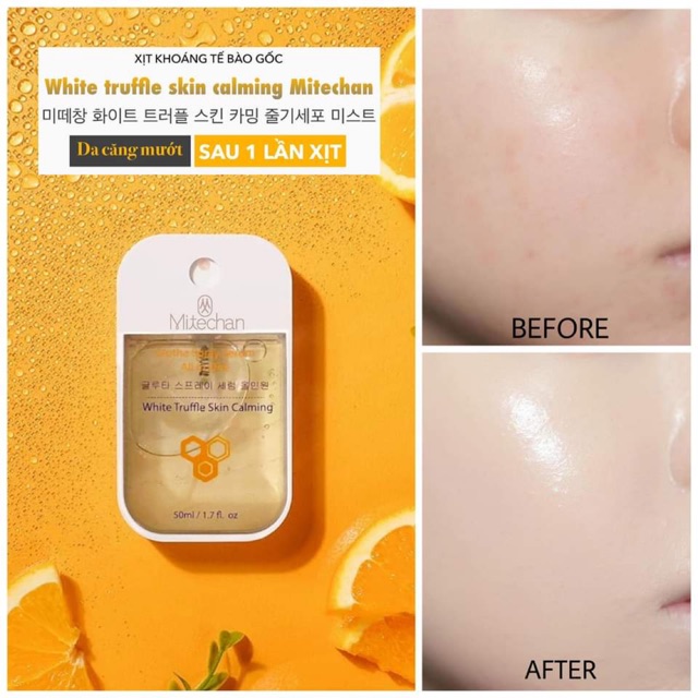 Xịt Khoáng Tế Bào Gốc Chiết Xuất Từ Nấm Truffle Thượng Hạng Mitechan