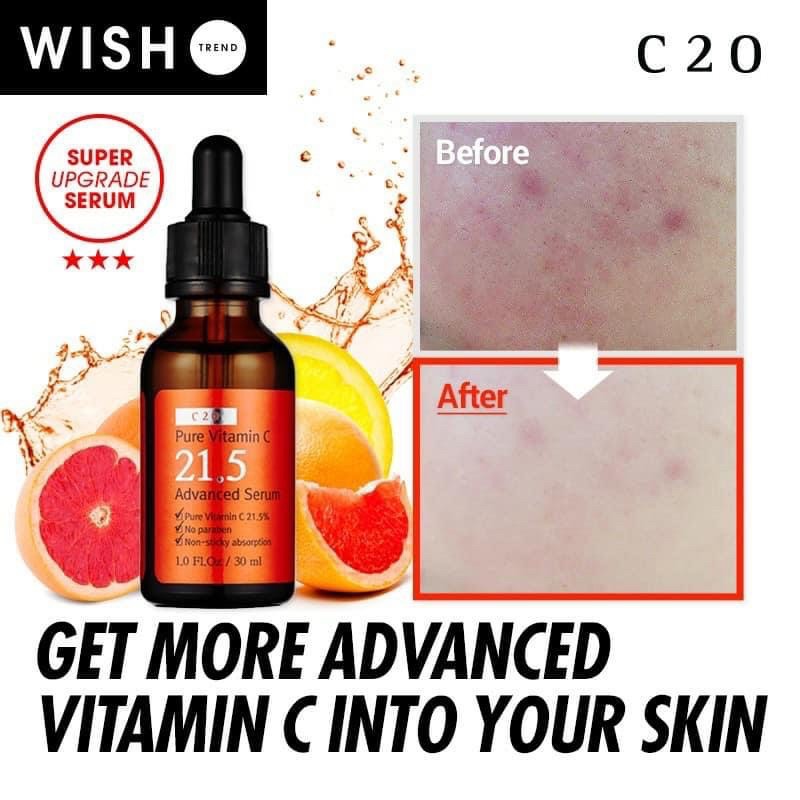 [Chính hãng] Tinh chất serum vitamin C giảm mụn ngừa thâm by wishtrend pure vitamin C 21.5 advanced serum 30ml