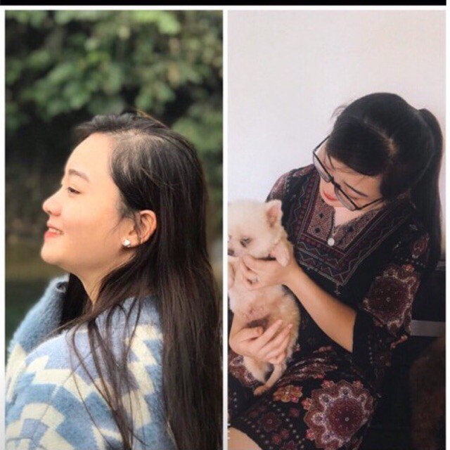 Xịt Mọc Tóc Tinh Dầu Bưởi Siquill ⚡𝑪𝒉𝒊́𝒏𝒉 𝑯𝒂̃𝒏𝒈 100%⚡ Mọc tóc nhanh giảm tình trạng hói sản phẩm thiên nhiên 100 | BigBuy360 - bigbuy360.vn