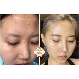 Mặt nạ thiên nhiên handmade