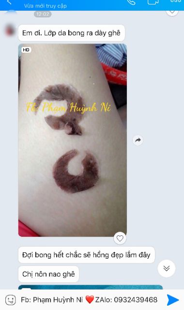 Body Active Peel 50ml: Peel hồng nhũ hoa và cô bé