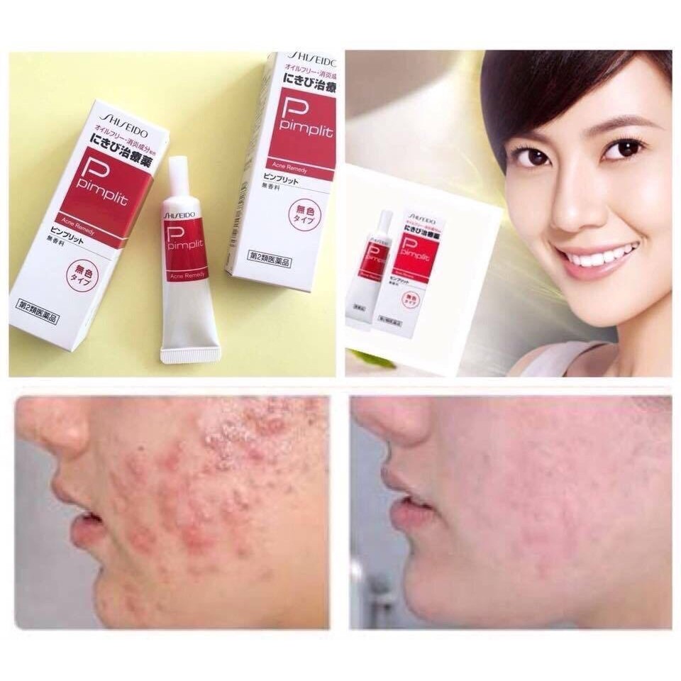 Kem Mụn Shiseido Pimplit Acne Remedy nội địa Nhật Bản