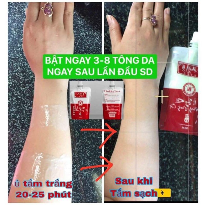 Kem ủ trắng da peel 1