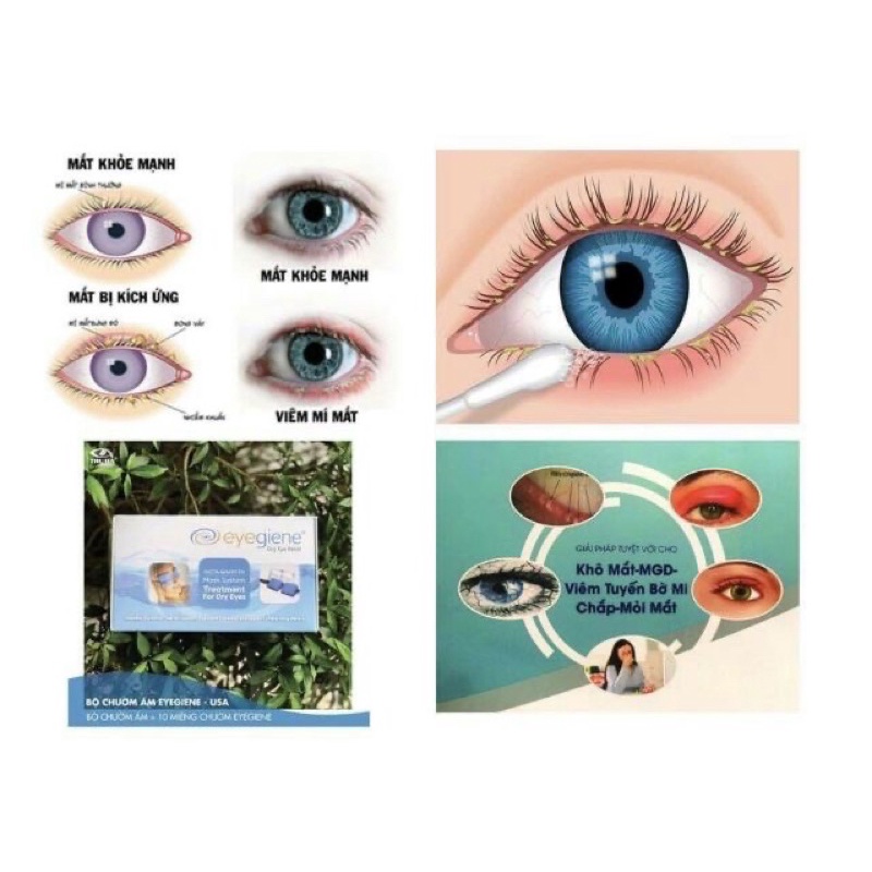 BĂNG và MIẾNG CHƯỜM ẤM MẮT EYEGIENE