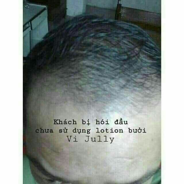 ( Tặng Ví Từ 2 Chai ) Tinh Dầu Bưởi Cao Cấp Vi Jully  - Trị Rụng Tóc Kích Thích Mọc Tóc Làm Dài Tóc | BigBuy360 - bigbuy360.vn